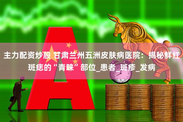 主力配资炒股 甘肃兰州五洲皮肤病医院：揭秘鲜红斑痣的“青睐”部位_患者_斑疹_发病